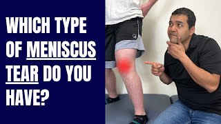 9 Types Of Meniscus Tears and What To Do Next [upl. by Egbert]