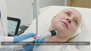 Radiofrekwencja mikroigłowa w Kaczyńscy Clinic [upl. by Misaq66]