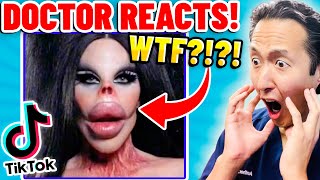 Plastic Surgeon Reacts to BOTCHED Plastic Surgery TikTok Videos [upl. by Asle]