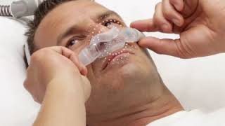 ResMed AirFit™ N30i Managing leaks Nasal CPAP mask [upl. by Zigmund]