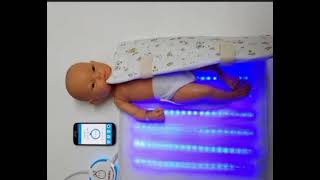 Biliblanket  use in tt of neonatal jaundice [upl. by Monahon]