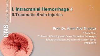 Intracranial hemorrhage and traumatic brain injury  شرح محاضرة [upl. by Cence]