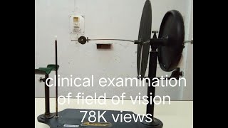 Field of Vision  Cranial Nerve II Examination  Perimetry [upl. by Aznarepse]