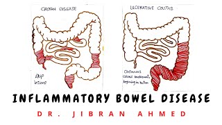 INFLAMMATORY BOWEL DISEASE II GIT II ROBBINS 10TH E II PATHOLOGY LECTURES II DrJIBRANAHMED [upl. by Husain]