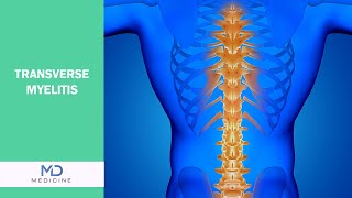 Understanding Transverse Myelitis Causes Symptoms and Treatment Options  mdmedicinenetwork [upl. by Kathlin]