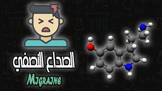 الصداع النصفي  Migraine [upl. by Iznekcam]