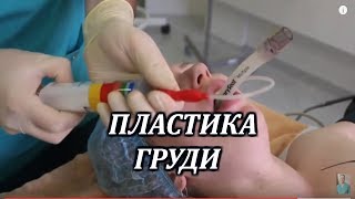 Общий наркозУвеличение грудных желёз [upl. by Asina]