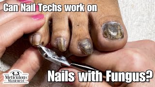 Pedicure Nail Fungus Transformation [upl. by Leiruh]