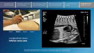 Advanced screening views of the fetal heart  Part 6  Longitudinal views [upl. by Araihc]