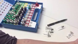 Allergietest  Prick Test [upl. by Wagoner169]