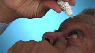 How To Insert Eyedrops [upl. by Areek]