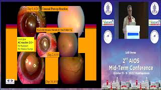 AIOCMTC2 2023 GP63 topic Dr Lalit Verma Intravitreal Injections in Endophthalmitis [upl. by Howenstein]