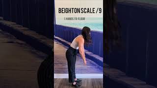 BEIGHTON SCORE HYPERMOBILITY or FLEXIBILITY [upl. by Jehias]