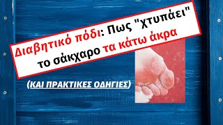 Πως ο σακχαρώδης διαβήτης quotχτυπάειquot τα πόδια [upl. by Ballman]