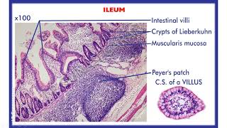 Histology of Small amp Large intestine Duodenum jejunum Ileum Vermiform appendix amp colon [upl. by Tnafni393]