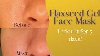 Flaxseed Gel Face Mask  I tried it for 5 days and this happened [upl. by Aliak]