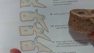 Atypical thoracic vertebrae [upl. by Aihsyn]