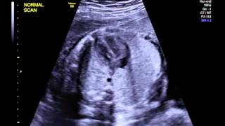 Normal overview of a fetal heart [upl. by Namya]