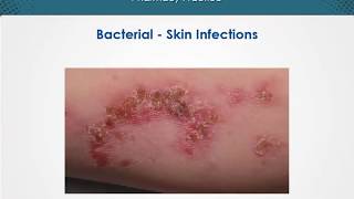 Bacterial skin infections  Dermatology  EduRx [upl. by Dewie]