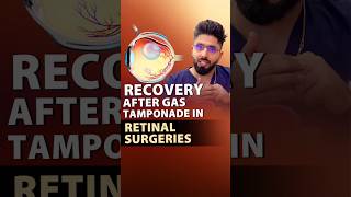 Recovery after Gas Tamponade in Retinal Surgeries [upl. by Snebur364]