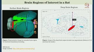 Lec 34 Neural Implants for Parkinsons Disease [upl. by Thomsen]