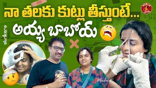 నా తలకి కుట్లు తీస్తుంటే అయ్య బాబోయ్  Madam Anthe  Strikers [upl. by Adelle44]