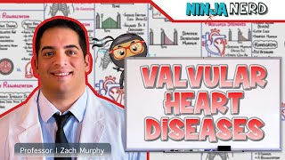 Valvular Heart Diseases  Clinical Medicine [upl. by Lunnete]