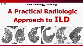 ILD A Radiologic Approach [upl. by Gelman]