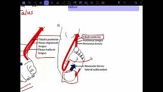 Talipes calcaneovalgus [upl. by Marilyn]