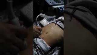 Practical abdominal ultrasound [upl. by Roselin555]