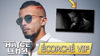 HAYCE LEMSI  ÉCORCHÉ VIF PREMIÈRE ÉCOUTE 🤘🔥 [upl. by Cletis]