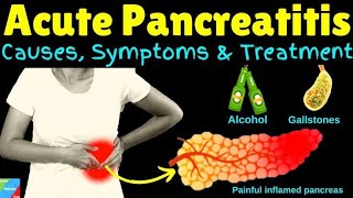 Pancreatitis Types signs and Treatment BSC Nursingyoutubevideos [upl. by Eiramnwad]