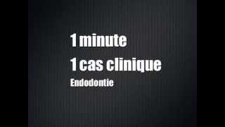 Une minute un cas clinique  Episode 1  Endodontie [upl. by Llenram]