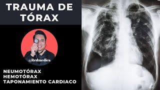 ATLS  Trauma de tórax  ENARM2021  🩺Dr Treviño [upl. by Leirud]