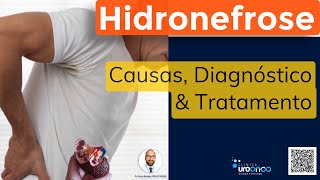 Hidronefrose Rim Dilatado  Como diagnosticar e tratar [upl. by Sarge]