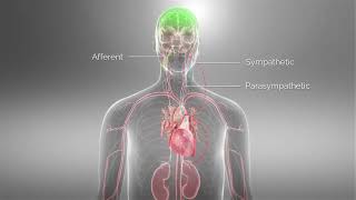 Barostim™ Baroreflex Activation Therapy Animation [upl. by Britton422]