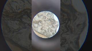 Human Skin Cells Under Microscope magnification microscope science shorts sciencelab [upl. by Lizette]