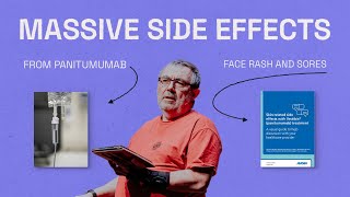 Huge Side Effect to Panitumumab  The Big C in Me [upl. by Reema]