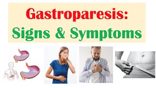 Gastroparesis Signs amp Symptoms ex Nausea Abdominal Pain Weight Loss [upl. by Bartolome]