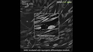 Stem cell differentiation into neuronal cells [upl. by Oicnerolf]