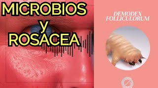 La MICROBIOTA y enfermedades de la piel como la ROSACEA [upl. by Anayd42]