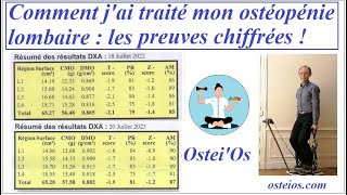 Témoignage  traitement naturel de lOstéoporose et lOstéopénie vertébrale [upl. by Naihtsirc]