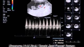 Ultrasonography Pregnant dogs 2132 days [upl. by Gudrun947]