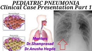 PEDIATRIC PNEUMONIA Part 1 Clinical Case Presentation [upl. by Kessiah]