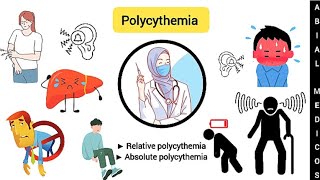 Polycythemia  Relative polycythemia  Absolute polycythemia  Polycythemia Vera [upl. by Calysta]