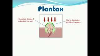 Get Rid of Plantar Warts in 24 weeks flat [upl. by Jorrie342]