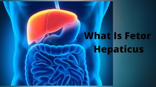 What Is Fetor Hepaticus [upl. by Naginnarb]