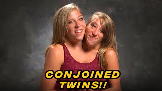 ALL YOU NEED TO KNOW About TLC Conjoined Twins Abby amp Brittany [upl. by Refannej]