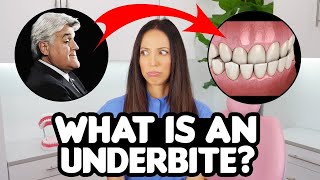 Underbite Correction EXPLAINED causes amp treatments [upl. by Lezley942]