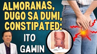 Almoranas Dugo sa Dumi Constipated Ito Gawin By Doc Willie Ong [upl. by Aiuoqes]